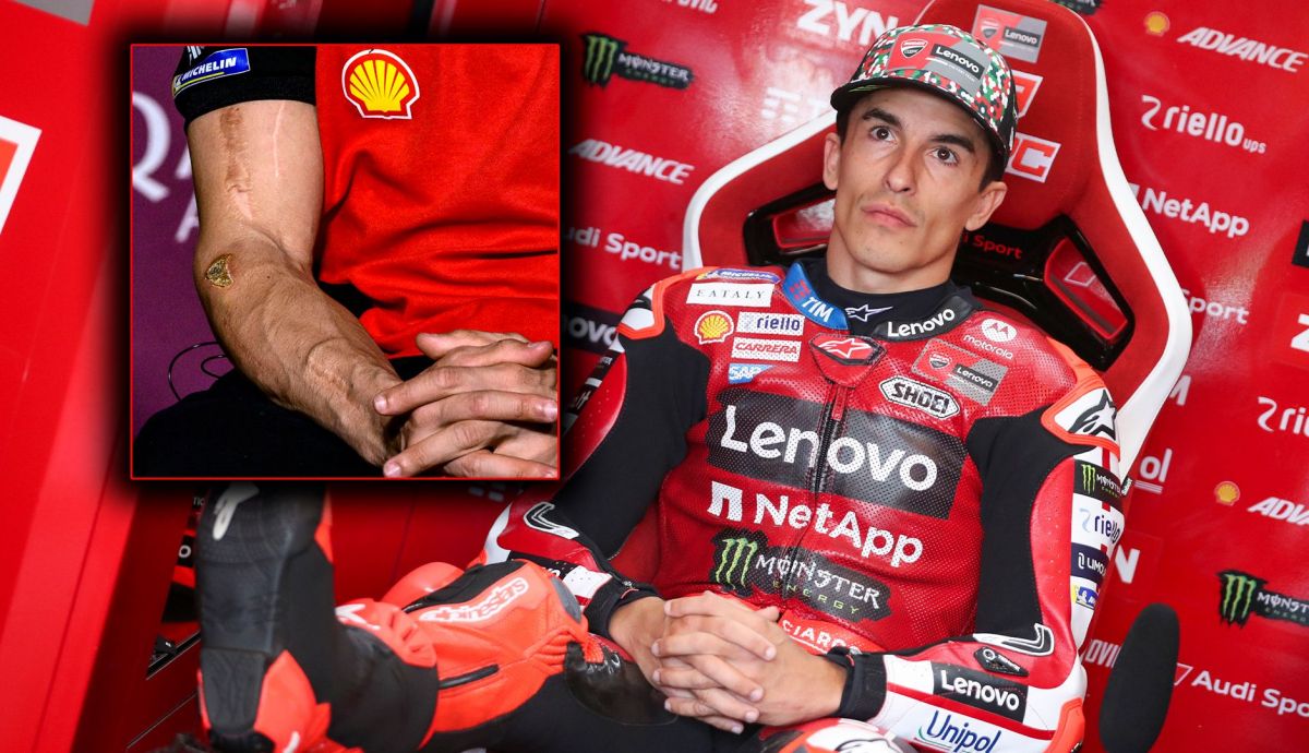 "He visto a Marc Márquez cansado y dolorido, pero contento": el análisis de Hospitality MOTOCICLISMO