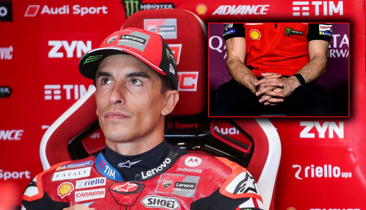 El médico que operó a Marc Márquez explica el estado real...