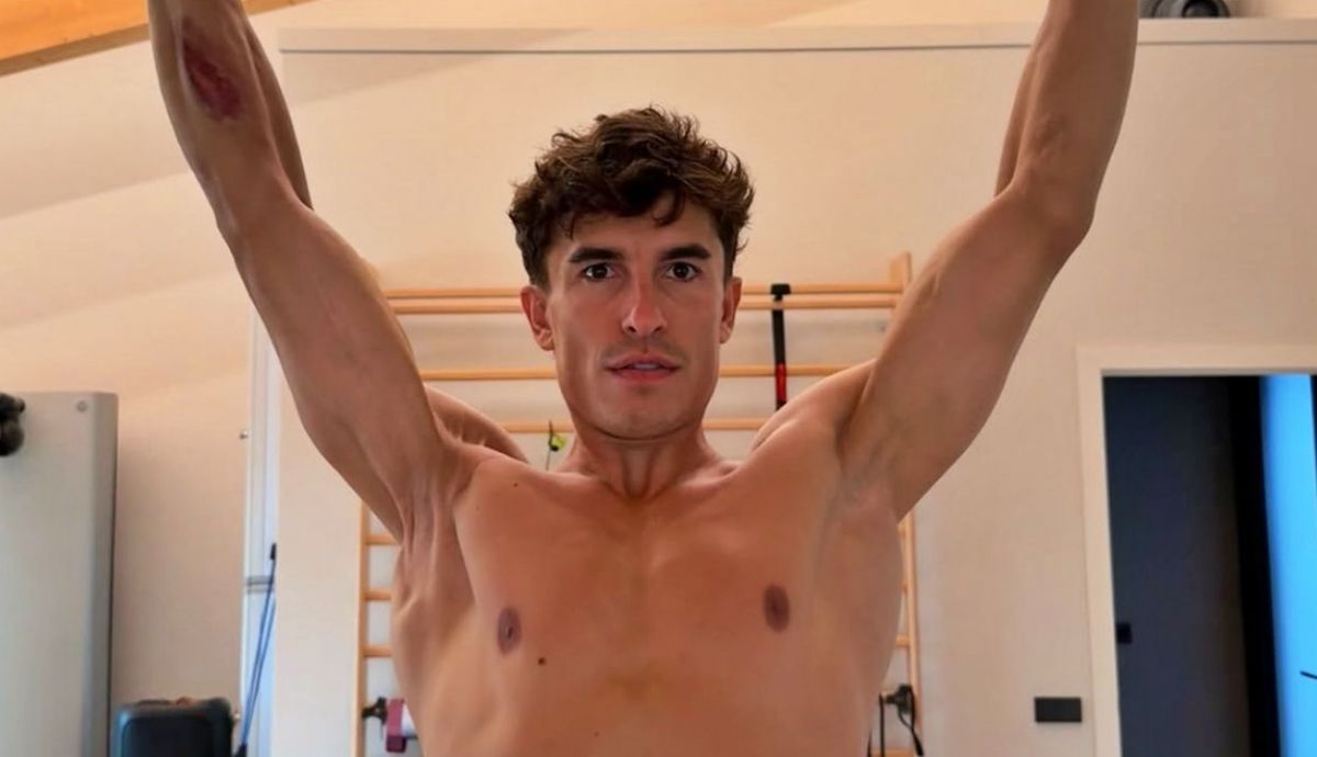 El brazo derecho Marc Márquez, imagen que vale mil palabras